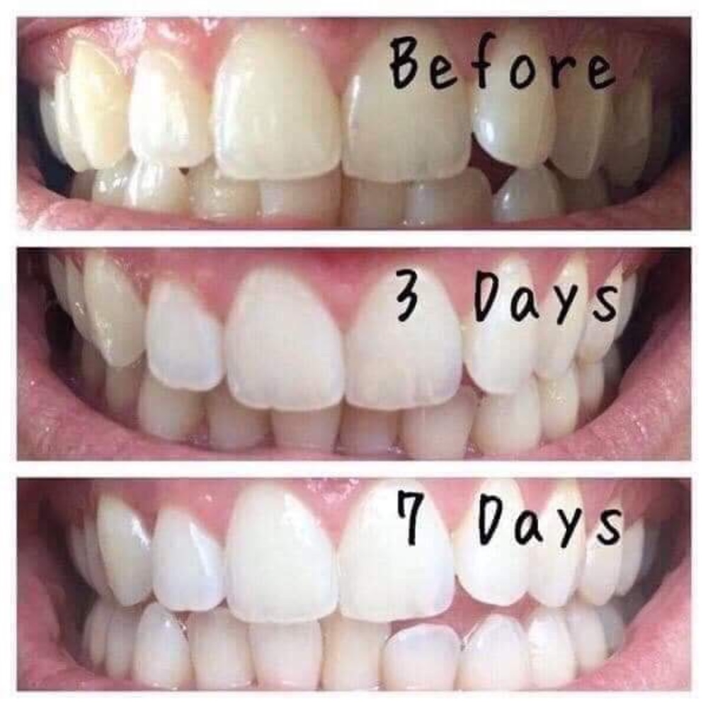Toothpaste - Picture 6 of 7